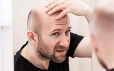 The Secret Dangers of Pharmaceuticals for Hair Loss Prevention