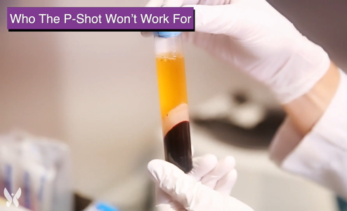 Surgeon in white gloves holding a sample of P-Shot in a test tube