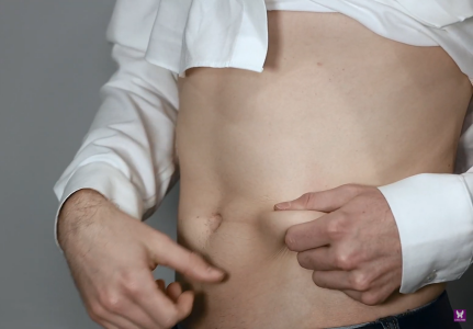 Man pulling his tummy skin, injection site