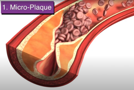 Micro-Plaque